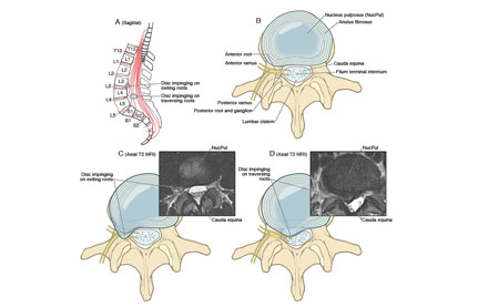 Figure from chapter 9 of Haines neuroanatomy in clinical context